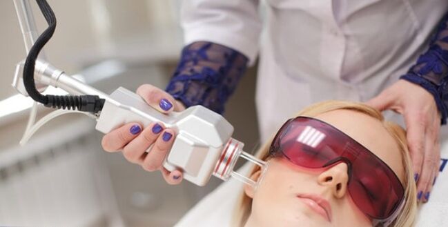 Principes de rajeunissement du visage avec le laser